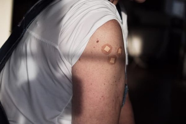 Quand et comment utiliser les pansements hydrocolloïdes pour les plaies chroniques?